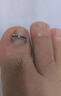 脚医生甲沟炎矫正器神指甲长肉里嵌甲纠正专用正甲贴片 实拍图
