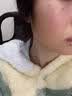 井次制药去痣点痣膏水无痕脸部痦子扁平疣瘊子面部黑痣男女士通用 实拍图