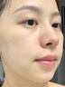 医用精华液械字号收缩毛孔粗大修复细致去黑头粉刺闭口男士女士祛痘印黑色素沉淀控油淡化痘印痘坑透明质酸钠 实拍图