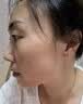 藤石制药激光点痣后脸部去红印黑印凹陷修复凝胶祛痣疤痕膏淡化红印色素DS 单盒装 实拍图
