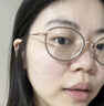 沃朗森医用面膜械字号冷敷贴医美术后补水修复祛痘印消炎透明质酸钠礼盒 实拍图