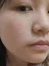 美白祛斑霜100%强效第1名淡化老年黄褐雀斑黑色素一夜消专用的药 2025新科技 男女医用【1支装】 实拍图