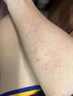 涩冈制薬日本湿疹药膏湿疹皮肤瘙痒皮炎皮癣真菌感染止痒膏专用肛门周1盒 实拍图