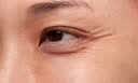 本桑眼贴膜淡化细纹去眼袋黑眼圈提拉紧致抗皱鱼尾纹眼角纹去除 实拍图