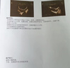 炬新一医用近红外线理疗灯腰椎颈椎红光烤灯理疗仪关节炎治疗仪 【药监新国标】H-L-DNC100标准款150VA 晒单实拍图