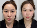 奈皙日本面霜抗皱紧致抗衰老40岁胶原蛋白肽淡纹保湿专用女男士护肤品 实拍图