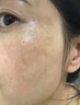 Newliann烟酰胺医用级凝胶正品和熊果苷乳膏搭配祛斑美白霜去黑色素精华液 实拍图