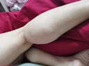 关德兴香港宝芝林静脉曲张专用膏蚯蚓腿精索血管堵塞疏通凝胶可搭弹力袜 实拍图