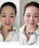 纽乐葆麦卢卡水乳妈妈护肤品套装情人节保湿爽肤水秋冬换季水乳官方正品 麦卢卡3件套 清爽温和【洁面+水+乳】 实拍图