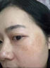 美容白醋美容院专用洗脸专用护肤祛斑美i白淡斑黑色素3.5度精华水 1瓶500ml白醋液 实拍图