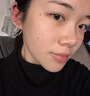 井次制药去痣点痣膏水无痕脸部痦子扁平疣瘊子面部黑痣男女士通用 实拍图