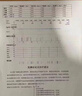 ASTACURE家用止鼾器防打呼噜止鼾神器呼吸重度机打鼾男士家用治根的専用药 实拍图
