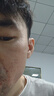 同仁堂脱毛膏永久根去不再生长私密处胡子腋下面部腋毛全身男女士专用 实拍图