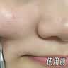 BUV蔡徐坤小绿泥叶绿素氨基酸洗面奶控油去黑头收毛孔洁面深层清洁 实拍图