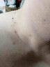 维A酸乳膏去疣体特新效期药扁平疣专用药去疣类药膏去脖子小肉粒颈部瘊子去尤瘊小肉粒去疣膏瘊子肉刺肉粒 1盒装【国药准字脱疣瘊】 瘊子去除国药准字药膏  放心购买 安心售后 实拍图