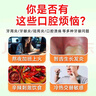 迪康牙痛药水5ml*2支+奥可安甲硝唑口颊片3mg*20片牙周炎止痛杀菌防蛀风火牙痛牙龈红肿 实拍图