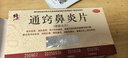 修正 修正 通窍鼻炎片0.3g*12片*3板/盒散风固表 宣肺通窍 用于风热宣肺 表虚不固所致的鼻塞时轻时重  实拍图