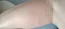 中三院静脉曲张弹力袜医用治疗型压力袜术后护小腿中老年春夏薄款男女 医用一级治疗型（中筒露趾） 肤色M码 参考体重90-110斤 实拍图