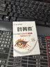 叶黄素滴眼液眼疲劳干涩痒眼睛水酸胀视力模糊叶黄素保健液 1瓶 实拍图