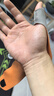 Olera日本大拇指护腕腱鞘炎医用防扭伤TFCC护手腕透气运动鼠标手妈妈手 实拍图