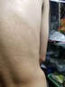 [拜都帮]曲安奈德益康唑乳膏 汗斑花斑癣专用药汗斑专用药(发货特效)真菌感染皮肤用药皮肤白斑汗斑净 15g 3支装 【大片白斑黄斑红斑】 实拍图