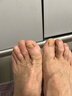 灰指甲特傚效专用的药指甲增厚发黄变厚变空真菌感染日本原装进口 买2发3【99w患者全愈】医师推荐 京东小店灰指甲用什么药好的快灰指甲专用大药膏房 实拍图