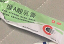 维A酸乳膏去疣体特新效期药扁平疣专用药去疣类药膏去脖子小肉粒颈部瘊子去尤瘊小肉粒去疣膏瘊子肉刺肉粒 1盒装【国药准字脱疣瘊】 瘊子去除国药准字药膏  放心购买 安心售后 实拍图