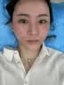 胶原蛋白肽三型寡肽原液蓝铜胜肽冻干粉祛斑后修复医用美容院专用 20对【40瓶】医美院线专用祛斑后修复冻干粉 实拍图