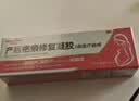 Newliann妊娠纹修复霜产后去除肥胖纹生长纹消除紧致肚皮剖腹产祛疤痕药膏 实拍图