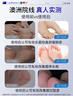 Layanana脚气喷剂止痒脱皮烂脚丫真菌感染脚臭脚痒改善足部抑菌喷雾剂60ML 实拍图
