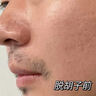 LOROLI澳洲高端脱毛膏男士脱胡子私密处永久去根不再生长医用腋下唇面部 【男士专研0痛感0黑点】一瓶装 实拍图