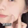 胶原蛋白肽三型寡肽原液蓝铜胜肽冻干粉祛斑后修复医用美容院专用 20对【40瓶】医美院线专用祛斑后修复冻干粉 实拍图
