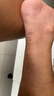 佳普医用跟腱靴踝关节固定支具跟腱断裂术后康复石膏鞋助行脚骨折扭伤 跟腱可用+双气囊+康复必备套装L【41~45码】 实拍图