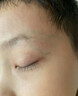 BKWILD医用重组生长因子凝胶胶原蛋白点痣喷人表皮祛疤痕膏修复生肌膏 实拍图