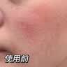 胶原蛋白肽三型寡肽原液蓝铜胜肽冻干粉祛斑后修复医用美容院专用 20对【40瓶】医美院线专用祛斑后修复冻干粉 实拍图