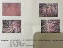 Flora Natura【专攻脱发生发】脂溢性脱发产后掉发雄激素防脱固发黑发育发密发 四盒周期装 20支*4盒 【买三送一,轻度脱发】 实拍图