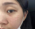 维特丝377美白爽肤水乳补水保湿水护肤精华水湿敷水淡斑护肤品细致毛孔 实拍图