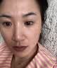 卡蜜妍蓝铜胜肽冻干粉术后修复医用皮肤屏障受损泛红祛斑美白祛黄提亮肤 1盒 44支 礼盒装（激光祛斑术后修复） 升级款（礼盒包装） 实拍图