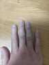 希格玛308白癜风治疗仪西格玛UVB银屑病紫外线准分子激光光疗仪医院同款 【SQ308PCHFD】50强度-重度手脚小面积 实拍图