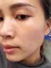 DR.MICKEY医用重组生长因子凝胶牛碱性成纤维细胞点痣喷人表皮祛疤痕膏修复 实拍图