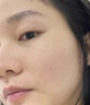 医用精华液械字号收缩毛孔粗大修复细致去黑头粉刺闭口男士女士祛痘印黑色素沉淀控油淡化痘印痘坑透明质酸钠 实拍图