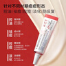 【20%浓度】喜辽妥壬二酸祛痘精华霜20%*15g祛痘控油光滑肌肤水杨酸凝血酸去痘痘淡改善黑头粉刺 实拍图