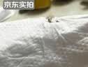 井次制药百部酊阴虱专用男士女私处喷剂去虱子药儿童头虱卵一扫光立净 实拍图