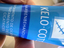 芭克kelocote官方硅凝胶巴克疤克祛疤膏治疗医用疤痕15g【618同价】 实拍图