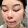 维特丝壬二酸15%凝胶祛痘药膏祛痘印淡痘印水杨酸胶态硫烟酰胺乳青春期 实拍图