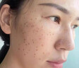 维特丝377美白爽肤水乳补水保湿水护肤精华水湿敷水淡斑护肤品细致毛孔 实拍图