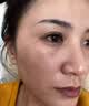 卡蜜妍蓝铜胜肽冻干粉术后修复医用皮肤屏障受损泛红祛斑美白祛黄提亮肤 1盒 44支 礼盒装（激光祛斑术后修复） 升级款（礼盒包装） 实拍图