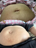 ELSIEDOCTOR医用妊娠纹产后修复霜祛疤膏祛疤痕修复凝胶肥胖纹生长纹专用非药 实拍图