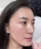 卡蜜妍蓝铜胜肽冻干粉术后修复医用皮肤屏障受损泛红祛斑美白祛黄提亮肤 1盒 44支 礼盒装（激光祛斑术后修复） 升级款（礼盒包装） 实拍图