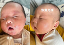 京儿肤乐霜 婴儿湿疹膏无激素0-3岁宝宝婴宝婴幼儿专用可搭身体乳止痒 鑫京儿肤乐霜15g【轻度癌痒】 全新包装-全新效期 实拍图